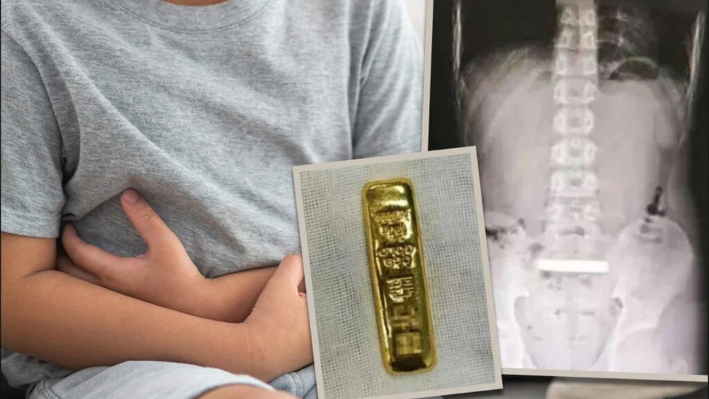 Gold Bar