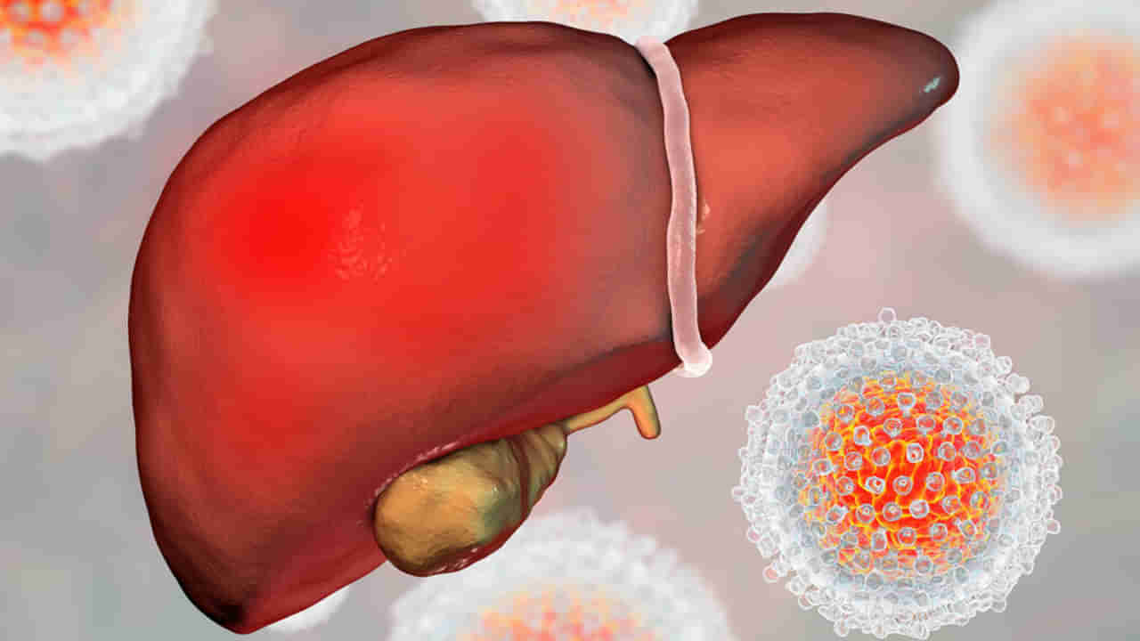 Andhra: కోనసీమ జిల్లాలో లివర్ ఇన్ఫెక్షన్.. విజృంభిస్తున్న వైరస్తో వణుకు