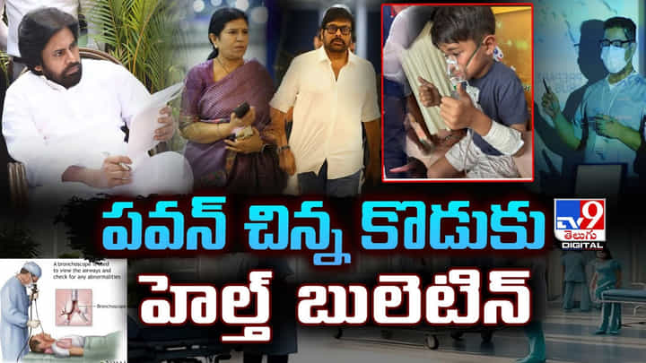 Mark Shankar Pawanovich: పవన్ చిన్న కొడుకు.. హెల్త్ బులెటిన్ విడుదల Mark Shankar Pawanovich: పవన్ చిన్న కొడుకు.. హెల్త్ బులెటిన్ విడుదల