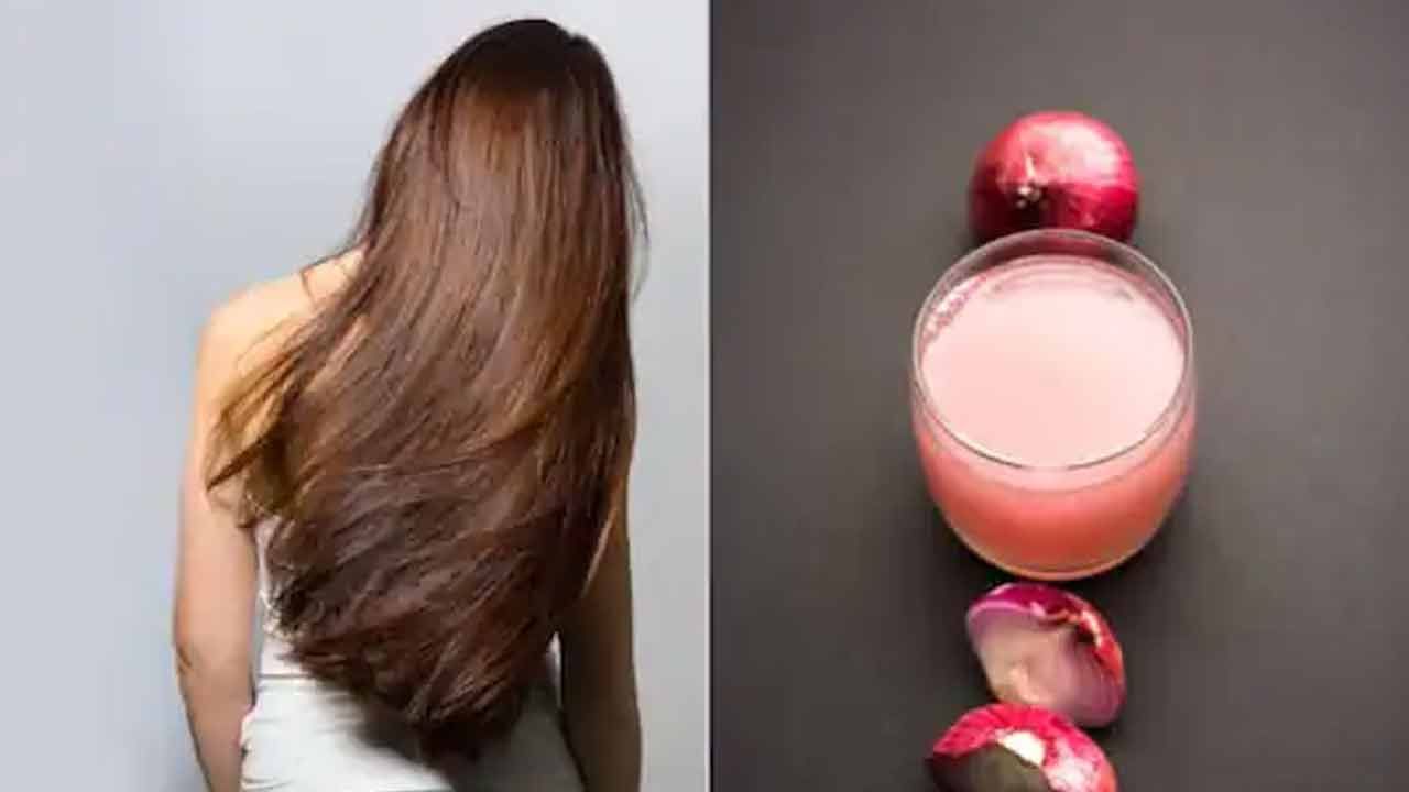 ఉల్లిపాయ రసంలో వీటిని కలిపి రాస్తే జుట్టు రాలడం తగ్గి.. ఒత్తుగా పెరుగుతుంది.. చుండ్రుకు చక్కని పరిష్కారం..