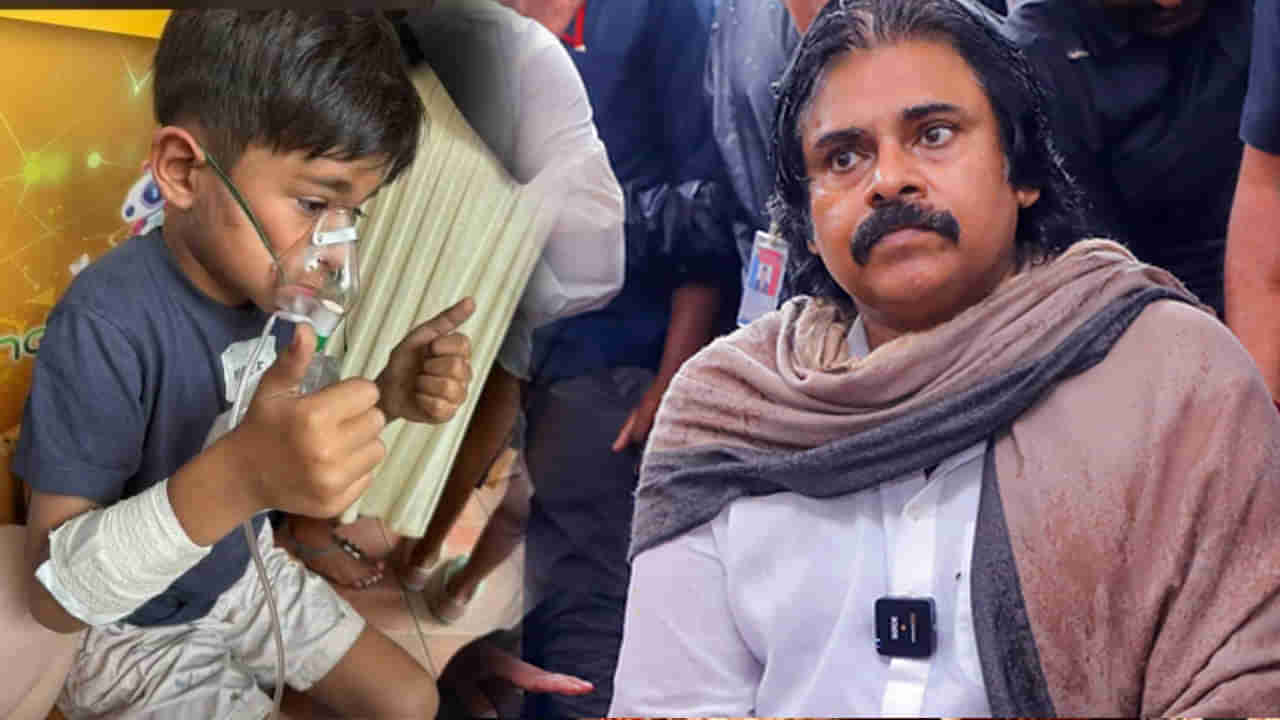 Pawan Kalyan Son: మార్క్ శంకర్ హెల్త్ అప్డేట్.. కోలుకుంటున్న పవన్ చిన్న కుమారుడు