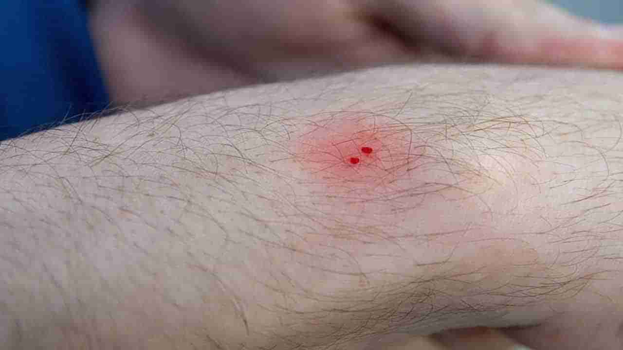 గాఢ నిద్రలో ఉన్న యువకుడి ఒంటిపై వింత గుర్తులు.. చూసి షాకైన కుటుంబీకులు.. అసలేం జరిగిందంటే..