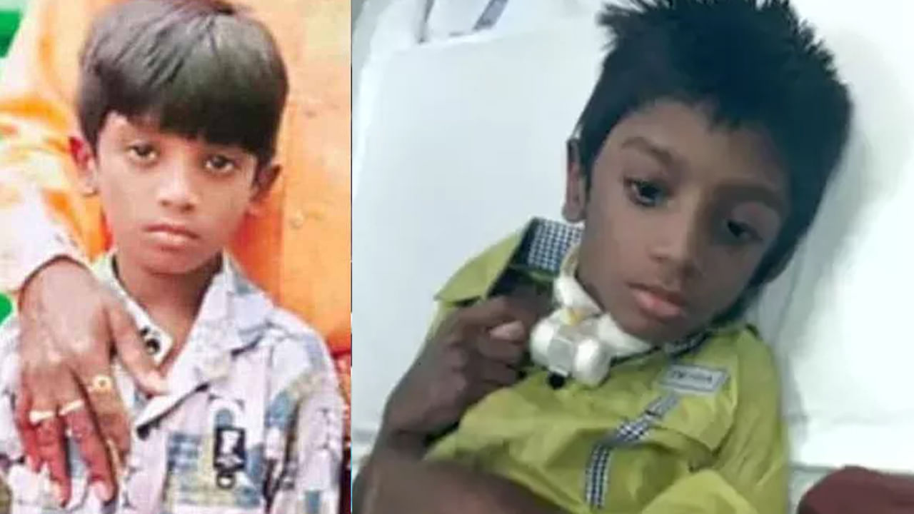 Sritej Health Update: ఆస్పత్రి నుంచి శ్రీతేజ్ డిశ్చార్జ్.. ప్రస్తుతం బాలుడి ఆరోగ్య పరిస్థితి ఎలా ఉందంటే..?