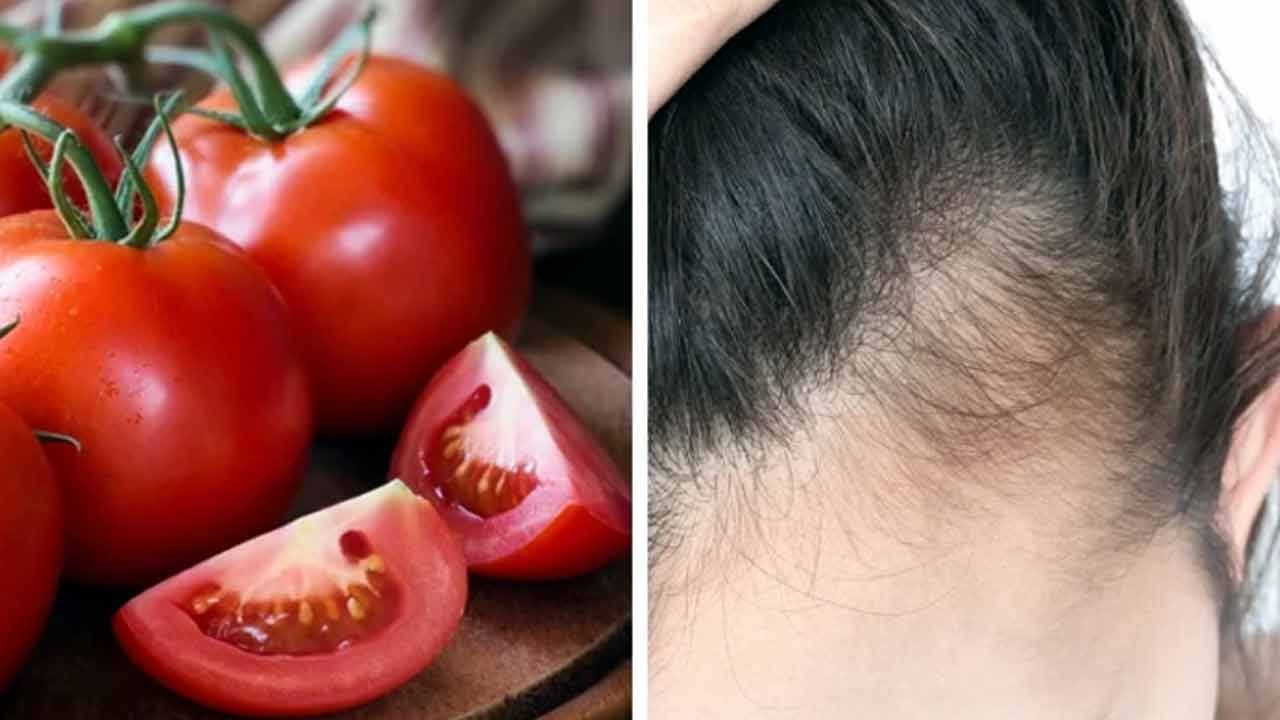 టమాటాను కలబందతో కూడా కలిపి జుట్టు అంతటికీ అప్లై చేయొచ్చు. ఇలా చేయడం వల్ల చుండ్రు తగ్గిపోతుంది. ఇందుకోసం రెండు స్పూన్ల టమాటా రసాన్ని తీసుకోండి. దీనిలో ఒక టేబుల్ స్పూన్ అలోవెరా జెల్ కలపండి. ఇది పేస్ట్ లాగా అవుతుంది. ఈ మెత్తని పేస్ట్‌ను జుట్టుకు బాగా పట్టించాలి.. 45 నిమిషాల పాటు అలా వదిలేయండి. ఆ తర్వాత తలస్నానం చేసి శుభ్రం చేసుకోండి. కలబంద నెత్తి మీద ఉన్న చర్మాన్ని శుభ్రం చేసి ఇన్ఫ్లమేషన్ ను తగ్గిస్తుంది. జుట్టు తిరిగి పెరగడాన్ని ప్రోత్సహిస్తుంది.