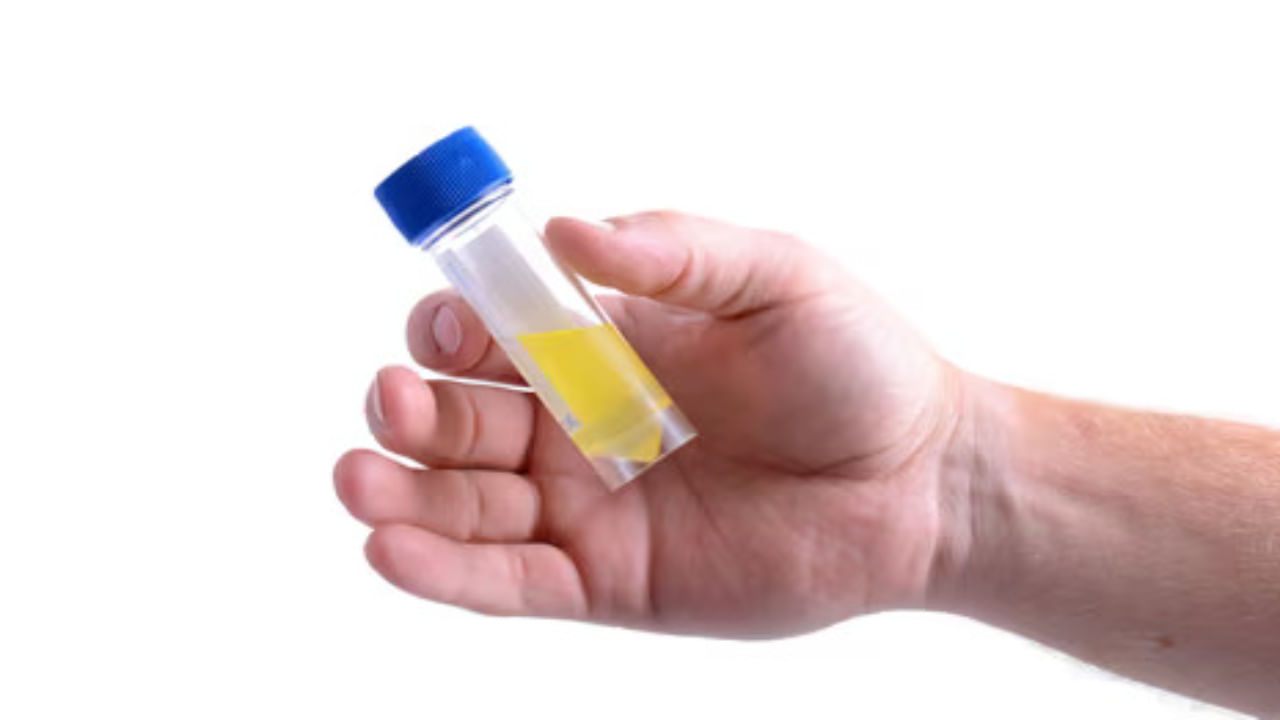Urine Remedy: మూత్రంతో ఆ వ్యాధులు నయమవుతాయా.. ఈ పురాతన పద్ధతి గురించి వైద్యులు ఏమంటున్నారు? Urine Remedy: మూత్రంతో ఆ వ్యాధులు నయమవుతాయా.. ఈ పురాతన పద్ధతి గురించి వైద్యులు ఏమంటున్నారు?