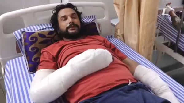 Viral Video: ప్రియుడి బొక్కలు చూరచూర చేసిన ప్రియురాలు... దెబ్బకు 13 ఫ్రాక్చర్లు..