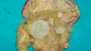 Andhra Rains: వచ్చే 3 రోజులు ఏపీలో వాతావరణం ఇలా – వెదర్ రిపోర్ట్ మీ కోసం