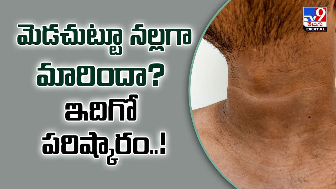 మెడ చుట్టూ నల్లగా మారిందా? ఇదిగో పరిష్కారం