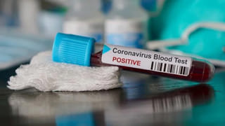 విశాఖ స్టీల్‌ప్లాంట్‌లో అగ్నిప్రమాదం