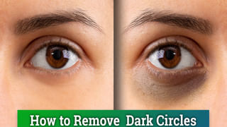 మొటిమలు, నల్ల మచ్చలతో ఇబ్బంది పడుతున్నారా..? అయితే వారానికి రెండుసార్లు ఇలా చేయండి