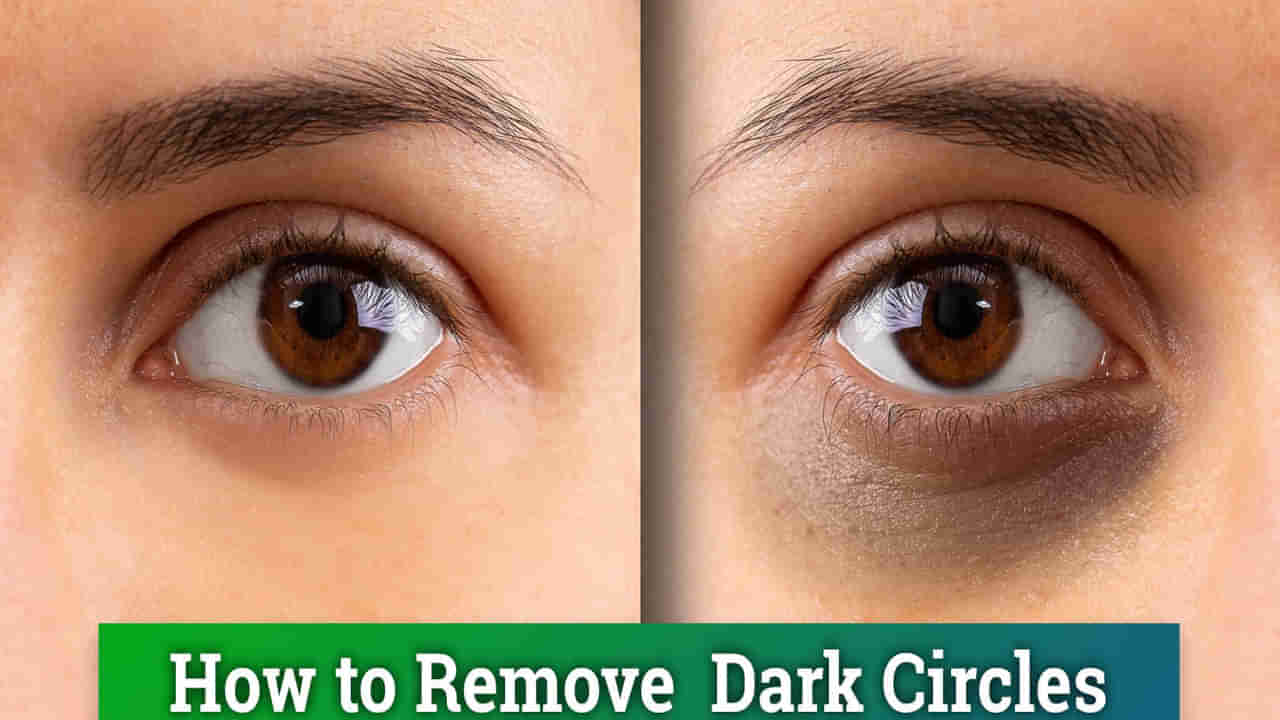 కళ్ల కింద నల్లటి వలయాలతో ఇబ్బందిపడుతున్నారా..? ఈ సింపుల్ టిప్స్తో మీ అందం రెట్టింపు...