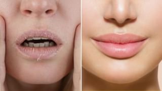 డార్క్ సర్కిల్స్ పోవాలంటే ఖరీదైన క్రీములే అవసరం లేదు..! మన ఇంట్లోనే సొల్యూషన్ ఉంది..!