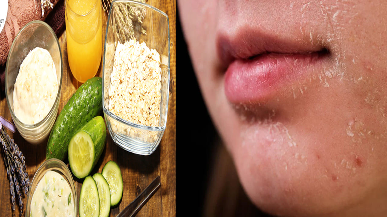 Skin Care Tips: చర్మం పొడి బారి ఇబ్బంది పెడుతోందా.. ఇంట్లోని వస్తువులతో ఈ చిట్కాలు ట్రై చేసి చూడండి..