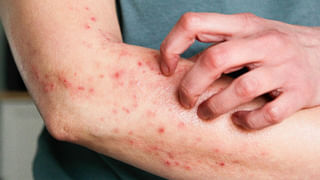 Patanjali: యోగా ఎప్పుడు చేయాలి? ఎలా చేయాలి? బాబా రామ్‌ దేవ్‌ చెప్పిన సూచనలు ఇవే..