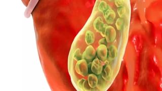 Magnesium Rich Foods: కంటి నిండా నిద్ర పట్టట్లేదా..? అయితే ఇవి తినండి.. టెన్షన్ మాయం, నిద్ర గ్యారెంటీ..!