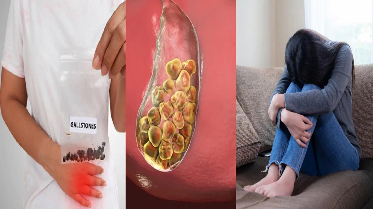 పిత్తాశయంలో రాళ్ళు ఎందుకు ఏర్పడతాయో తెలుసా..? ఇలా చేస్తే సేఫ్గా ఉండొచ్చట..