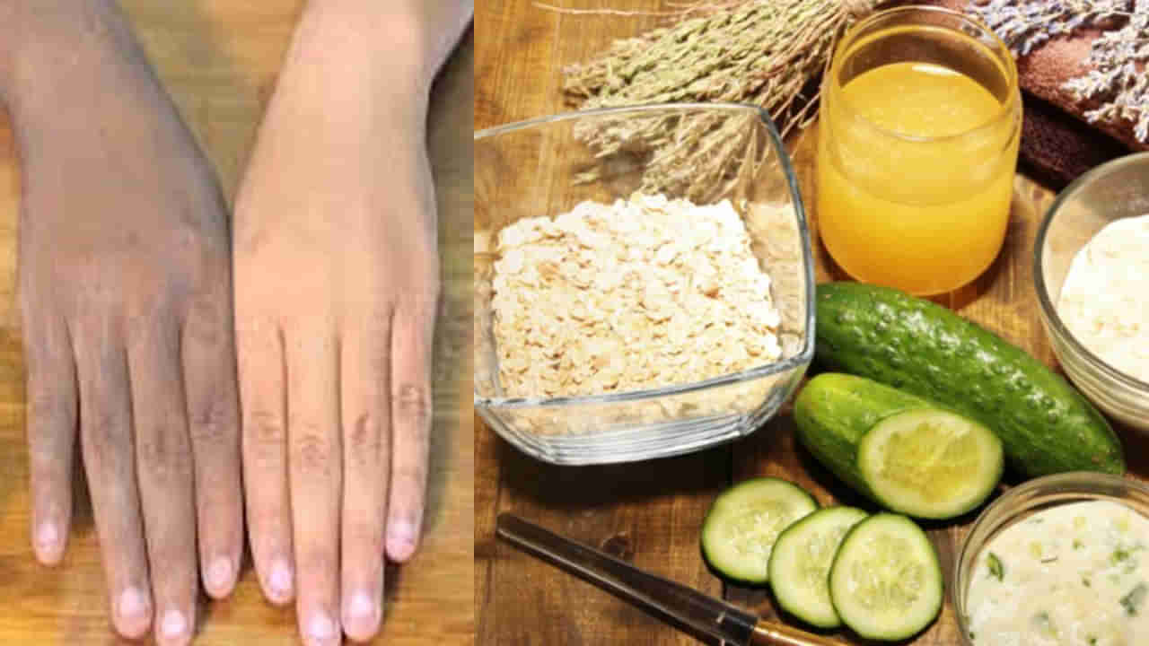 Skincare Tips: వేసవిలో చేతులపై టాన్ పేరుకుందా.. రంగుని మెరుగుపరిచేందుకు ఈ సింపుల్ టిప్స్ ట్రై చేయండి..