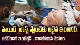 హెయిర్ ట్రాన్స్ ప్లాంట్కు బలైన ఇంజనీర్.. వికటించిన ఇంజెక్షన్.. హెయిర్ ట్రాన్స్ ప్లాంట్కు బలైన ఇంజనీర్.. వికటించిన ఇంజెక్షన్..