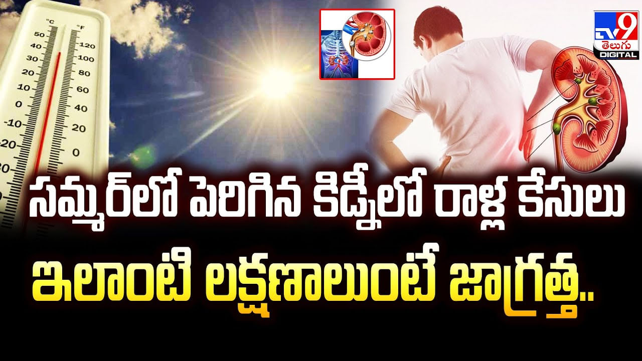సమ్మర్‌లో పెరిగిన కిడ్నీలో రాళ్ల కేసులు ఇలాంటి లక్షణాలుంటే జాగ్రత్త..