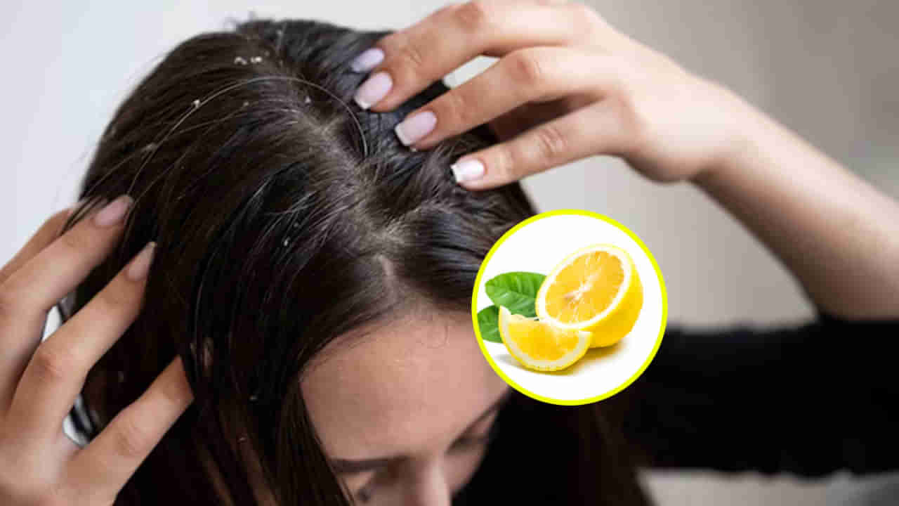 Lemon For Hair: నిమ్మ తొక్కలతో నిగనిగలాడే ఒత్తైన జుట్టు.. వీటిని ఎలా వాడాలంటే..