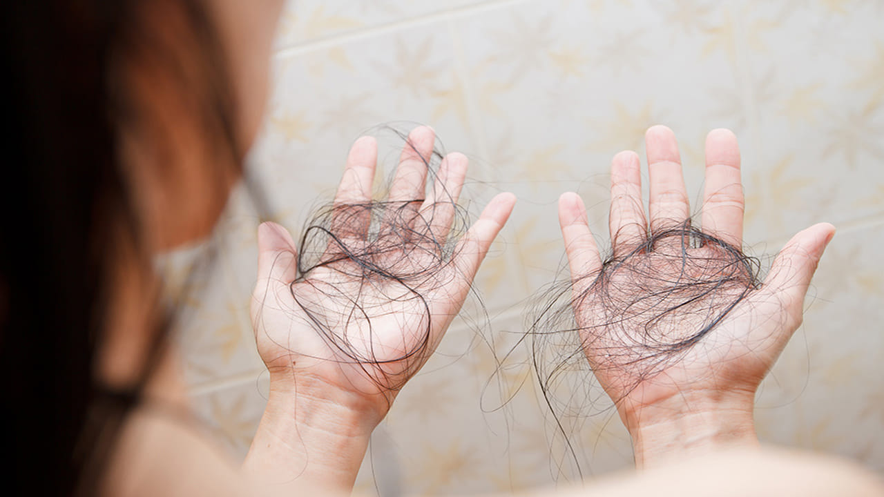 నిజానికి, మనం తీసుకునే ఆహారం మన జుట్టు, చర్మం పైన కూడా ప్రభావం చూపుతాయి. కాబట్టి చర్మం తాజాగా కాంతివంతంగా ఉండాలన్నా, జుట్టు కుదుళ్లు బలంగా మారాలన్నా పోషకాలున్న పదార్థాలను ఆహారంలో చేర్చుకోవడం ప్రథమ విధి. అందుకు గుడ్లు, పెరుగు వంటి మాంసకృత్తులు, విటమిన్‌-బి5 పుష్కలంగా ఉండే ఆహారాలు తీసుకోవాలి.