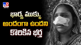 భార్య ముక్కు అందంగా ఉందని కొరికిన భర్త భార్య ముక్కు అందంగా ఉందని కొరికిన భర్త