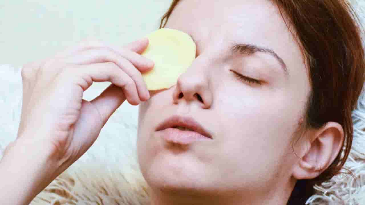 Raw Potato Side Effects: పచ్చి బంగాళాదుంపను ముఖానికి రాసే ముందు ఈ జాగ్రత్తలు తీసుకుంటున్నారా..?