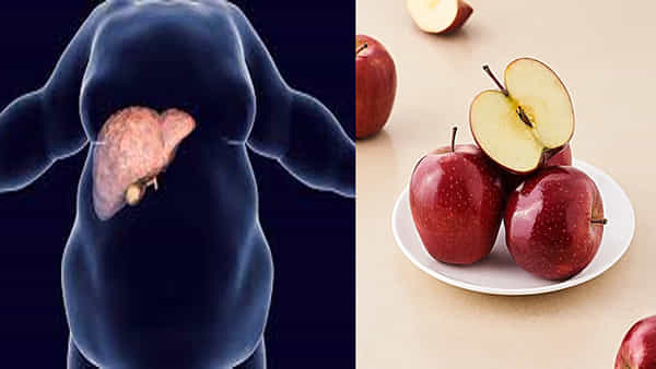 Fatty Liver Tips: ఫ్యాటీ లివర్ తో బాధపడుతున్నారా.. మందులు అవసరం లేదు రోజూ ఖాళీ కడుపుతో ఈ పండు తిని చూడండి..