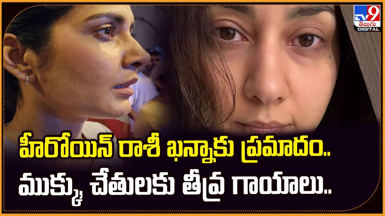 హీరోయిన్ రాశీ ఖన్నాకు ప్రమాదం.. ముక్కు, చేతులకు తీవ్ర గాయాలు..