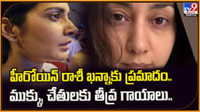 హీరోయిన్ రాశీ ఖన్నాకు ప్రమాదం.. ముక్కు, చేతులకు తీవ్ర గాయాలు.. హీరోయిన్ రాశీ ఖన్నాకు ప్రమాదం.. ముక్కు, చేతులకు తీవ్ర గాయాలు..