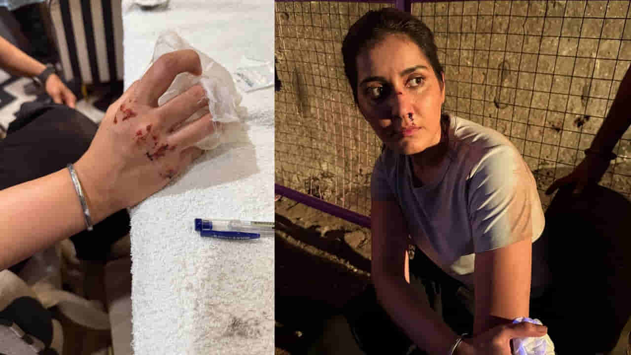 Raashii Khanna: హీరోయిన్ రాశీ ఖన్నాకు ప్రమాదం.. ముక్కు, చేతులకు తీవ్ర గాయాలు.. ఏం జరిగిందంటే?