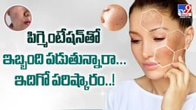 పిగ్మెంటేషన్తో ఇబ్బంది పడుతున్నారా..ఇదిగో పరిష్కారం వీడియో పిగ్మెంటేషన్తో ఇబ్బంది పడుతున్నారా..ఇదిగో పరిష్కారం వీడియో
