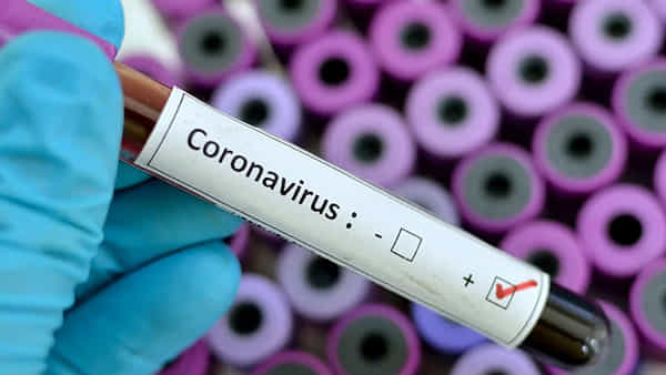 Covid-19: మరోమారు వైరస్ దాడి.. 9 నెలల చిన్నారికి కరోనా పాజిటివ్.. ఆరోగ్య శాఖ అలర్ట్..!