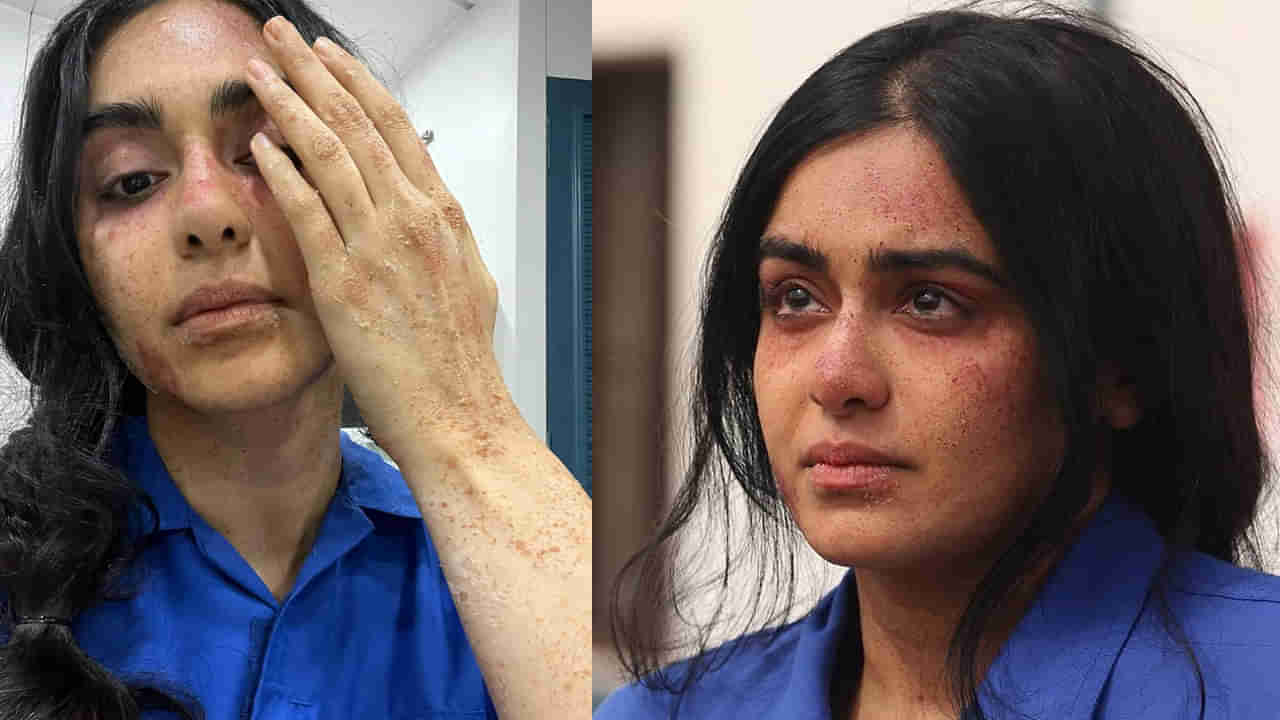 Tollywood: అరె.. ఈ టాలీవుడ్ హీరోయిన్‌కు ఏమైంది?  ఫొటోస్ వైరల్.. షాకవుతోన్న ఫ్యాన్స్