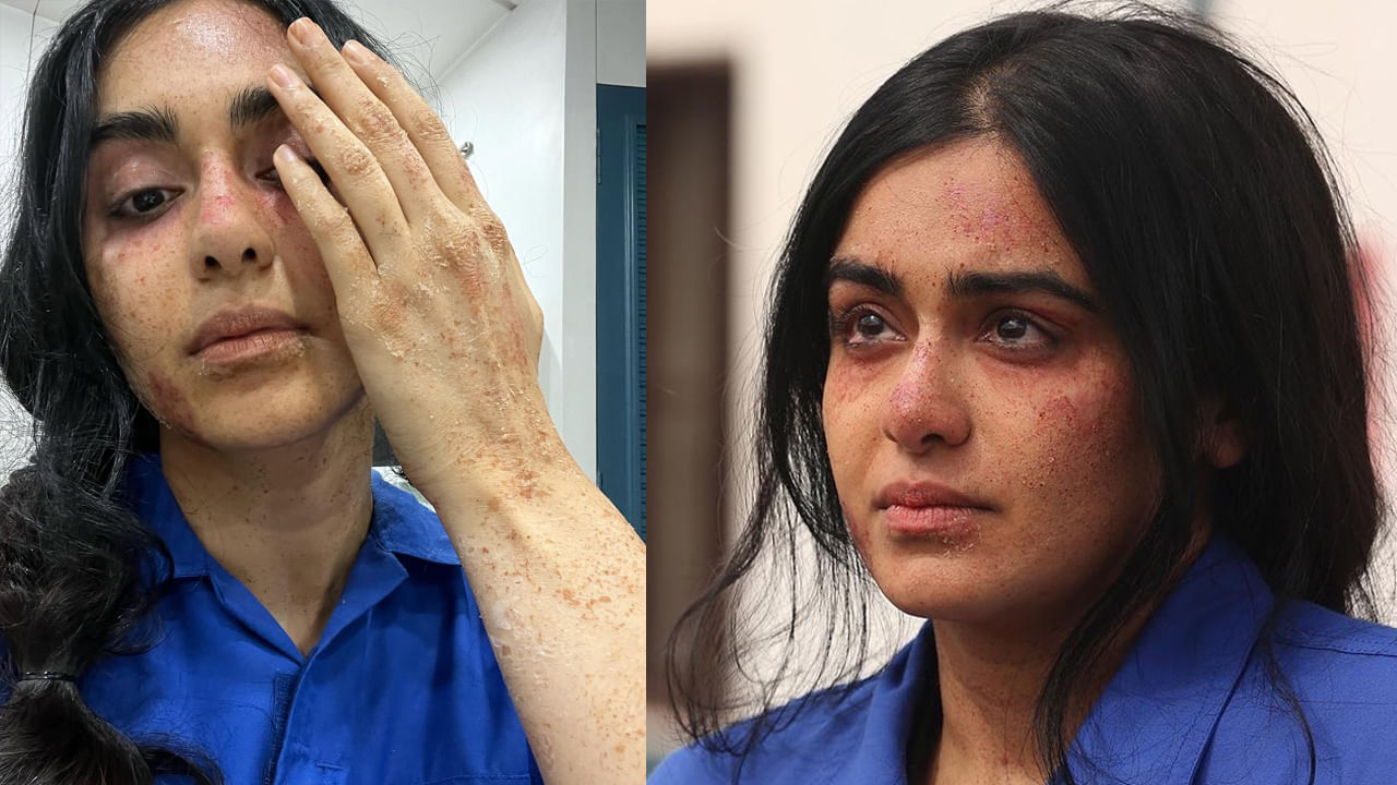 Tollywood: అరె.. ఈ టాలీవుడ్ హీరోయిన్‌కు ఏమైంది?  ఫొటోస్ వైరల్.. షాకవుతోన్న ఫ్యాన్స్