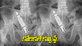 కవ్వించే కోరికలు.. పొరపాటున ప్రైవేట్ పార్టులోకి.. కవ్వించే కోరికలు.. పొరపాటున ప్రైవేట్ పార్టులోకి..