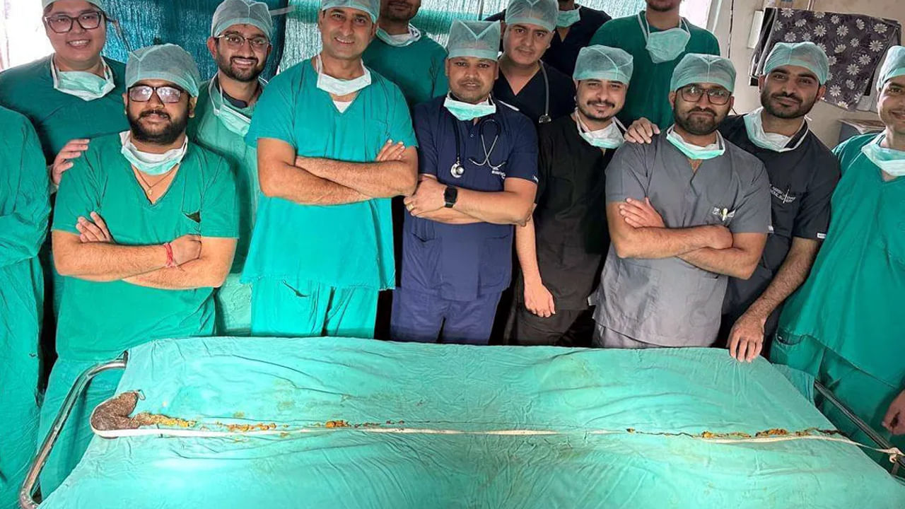 Viral News: విద్యార్ధికి తీవ్రమైన కడుపు నొప్పి, ఆగని వాంతులు.. ఆస్పత్రికి తీసుకెళ్లగా.. ఎక్స్రేలో డాక్టర్లకు