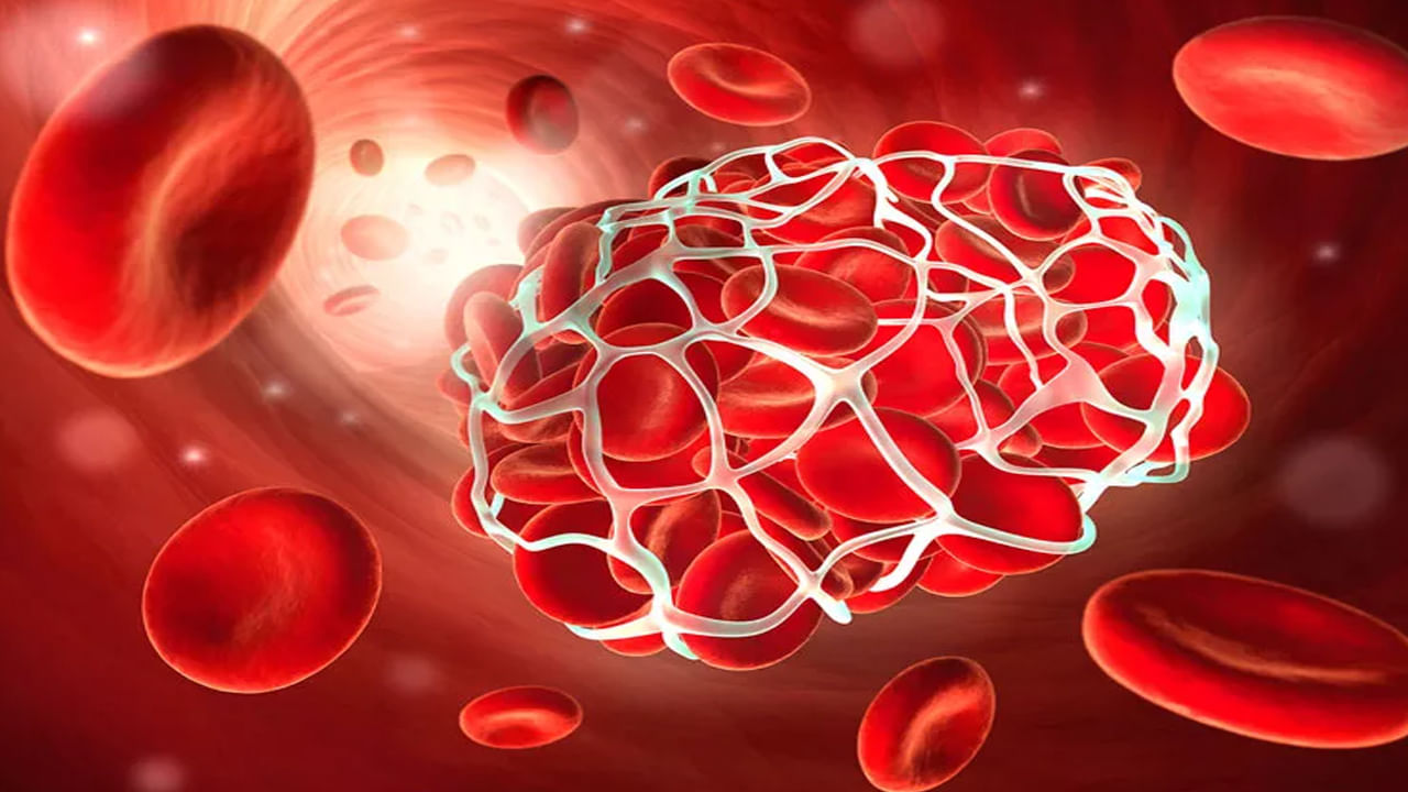 Vitamin K: మీలో ఇలాంటి లక్షణాలు కనిపిస్తే విటమిన్ k లోపం ఉన్నట్లు.. బీ కేర్‌ఫుల్.. !