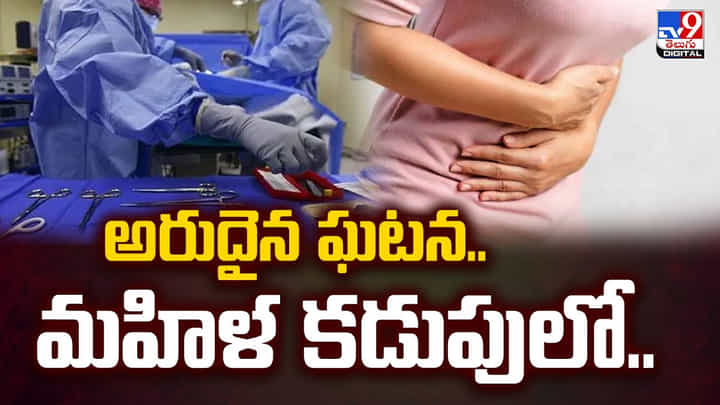 వాంతులు, కడుపునొప్పితో బాధపడిన మహిళ.. సీటీ స్కాన్ చేసిన వైద్యులకు షాక్ వాంతులు, కడుపునొప్పితో బాధపడిన మహిళ.. సీటీ స్కాన్ చేసిన వైద్యులకు షాక్