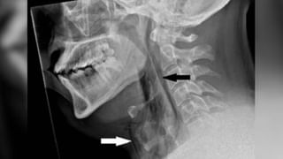 Viral Video: రౌండప్ చేసిన అడవి పందులు.. ఈ చిరుత చేసిన పని ఏంటో తెలిస్తే నివ్వెరపోతారు