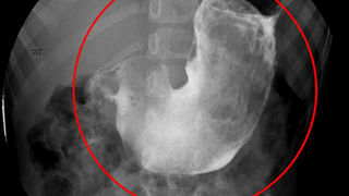 కొడుకు నిశ్చితార్థంలో సంతోషంగా డాన్స్ చేస్తూ.. కుప్పకూలిపోయిన తండ్రి.. చివరికి..!