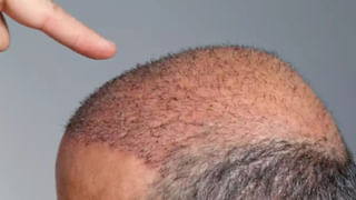 Telangana: ఆలయ సమీపంలోని లింగానికి పూజలు – కాస్త పక్కన చూడగా..