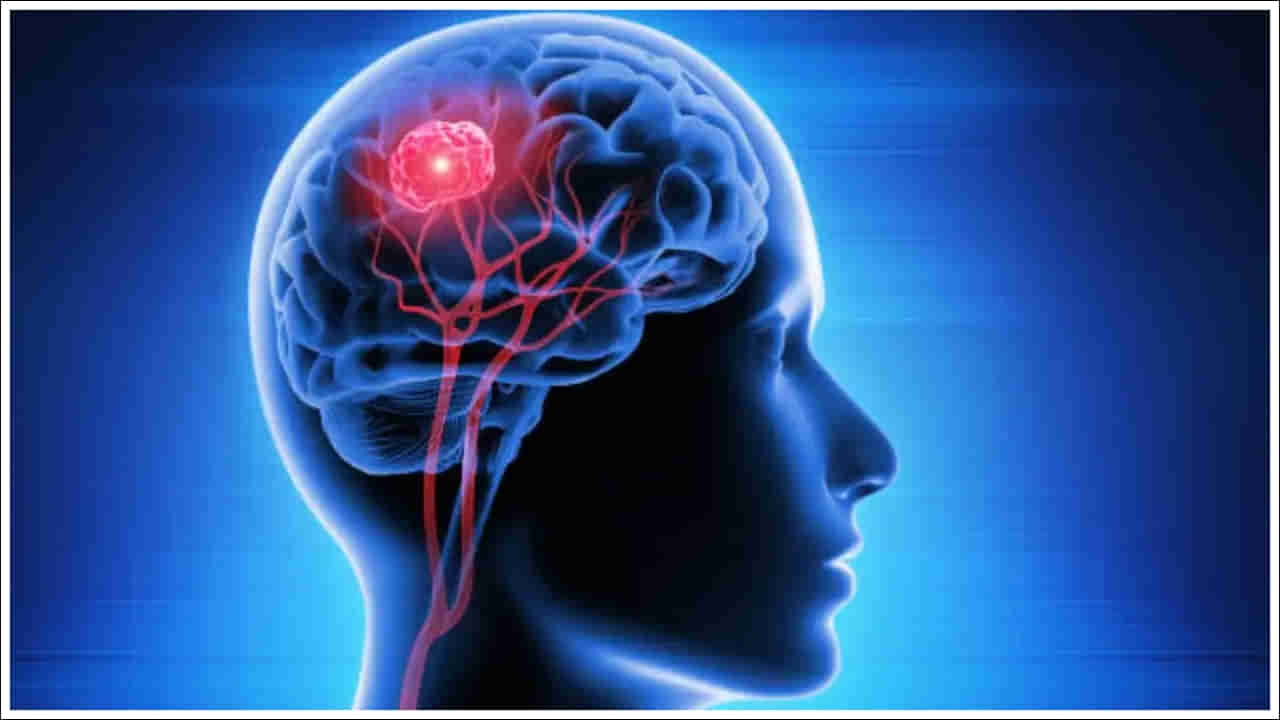 Brain Tumour: నిద్రపోతున్నప్పుడు ఈ 5 లక్షణాలు కనిపిస్తు బ్రెయిన్ ట్యూమర్ సంకేతాలు!