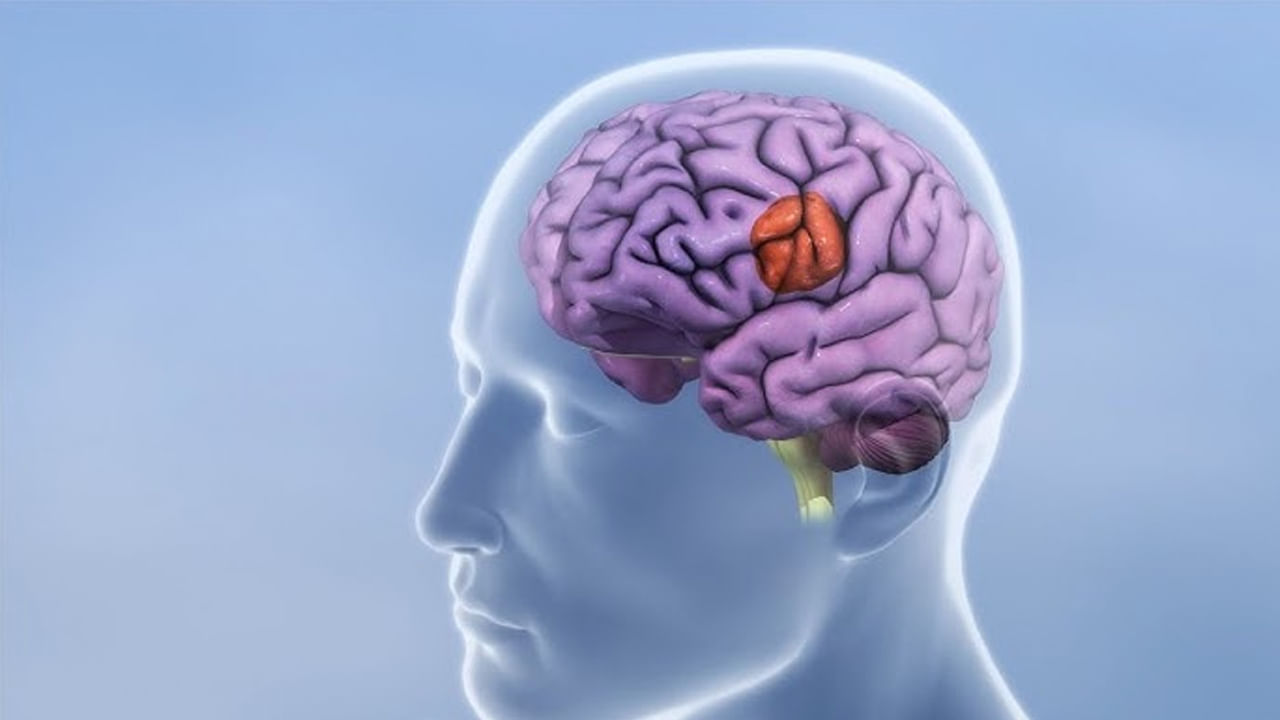 బ్రెయిన్ ట్యూమర్ అనేది తీవ్రమైన వ్యాధి. మెదడులో కణితి కనిపిస్తే దాన్ని బ్రెయిన్ ట్యూమర్ అంటారు. కొంత మంది ఆరోగ్యంగా ఉన్నప్పటికీ ఒక్కసారిగా దీని లక్షణాలు బయటపడుతుంటాయి. కాగా, దాని గురించే ఇప్పుడు మనం తెలుసుకుందాం.