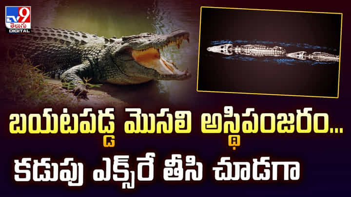 బయటపడ్డ మొసలి అస్థిపంజరం...కడుపు ఎక్స్రే తీసి చూడగా బయటపడ్డ మొసలి అస్థిపంజరం...కడుపు ఎక్స్రే తీసి చూడగా