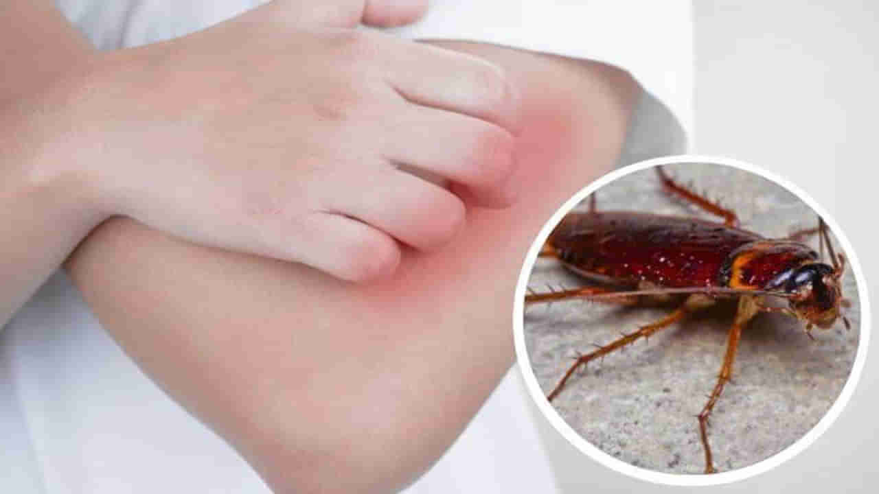 బాబోయ్‌.. బొద్దింకలు ఇంత డేంజరా..? ఇలాంటి వ్యాధులకు కారణం ఇదేనట..!