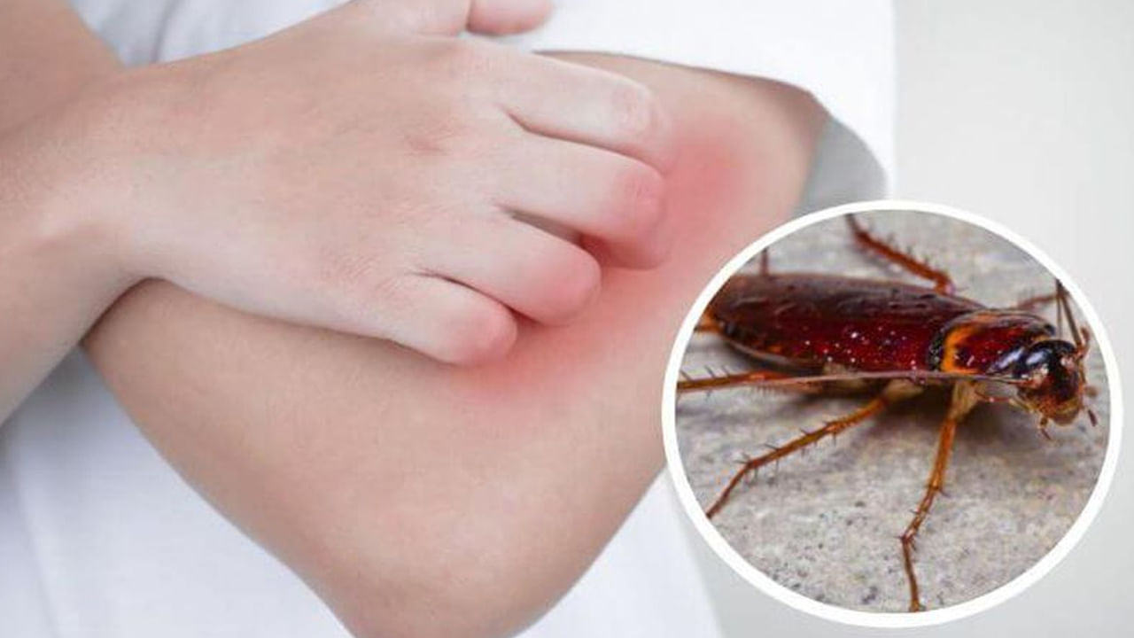 బాబోయ్‌.. బొద్దింకలు ఇంత డేంజరా..? ఇలాంటి వ్యాధులకు కారణం ఇదేనట..!