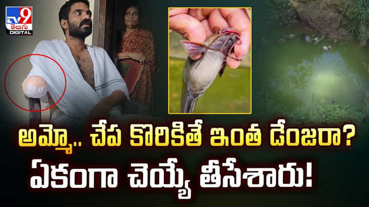 అమ్మో.. చేప కొరికితే ఇంత డేంజరా? ఏకంగా చెయ్యే తీసేశారు అమ్మో.. చేప కొరికితే ఇంత డేంజరా? ఏకంగా చెయ్యే తీసేశారు