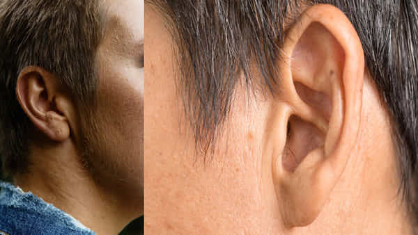 Hair on Ears: మీకూ చెవులపై వెంట్రుకలు ఉన్నాయా? అయితే మీరు బూరెల బుట్టలో పడ్డట్లే..