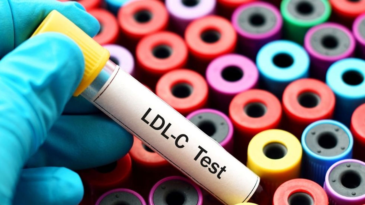 LDL స్థాయిల నిర్వహణ: చాలామంది బరువు లేదా BMI పై శ్రద్ధ చూపుతున్నప్పటికీ.. రక్త పరీక్షల సముంలో శరీరంలో కొవ్వు స్థాయిలో హెచ్చు తగ్గులు కనిపిస్తూ ఆరోగ్యం గురించి ఆందోళన కలిగిస్తున్నాయి. కనుక LDL కొలెస్ట్రాల్, హై-సెన్సిటివిటీ CRP (C-రియాక్టివ్ ప్రోటీన్), ఫాస్టింగ్ ఇన్సులిన్ స్థాయిలను క్రమం తప్పకుండా పరీక్షించడం వల్ల హృదయ, జీవక్రియ ఆరోగ్యం గురించి ఖచ్చితంగా తెలుస్తుంది. కనుక ఈ పరీక్షలు గుండె వ్యాధుల లక్షణాలు కనిపించడానికి చాలా సంవత్సరాల ముందే సమస్యలను గుర్తించగలవు.

